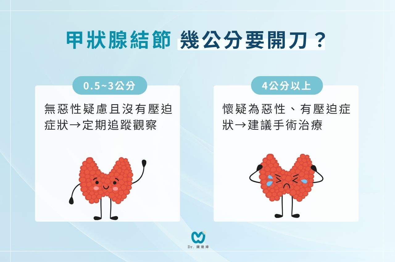 甲狀腺結節幾公分要開刀