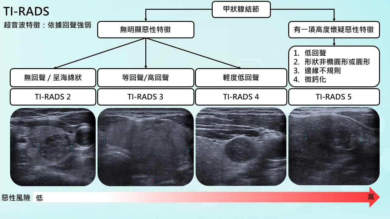 甲狀腺超音波大小