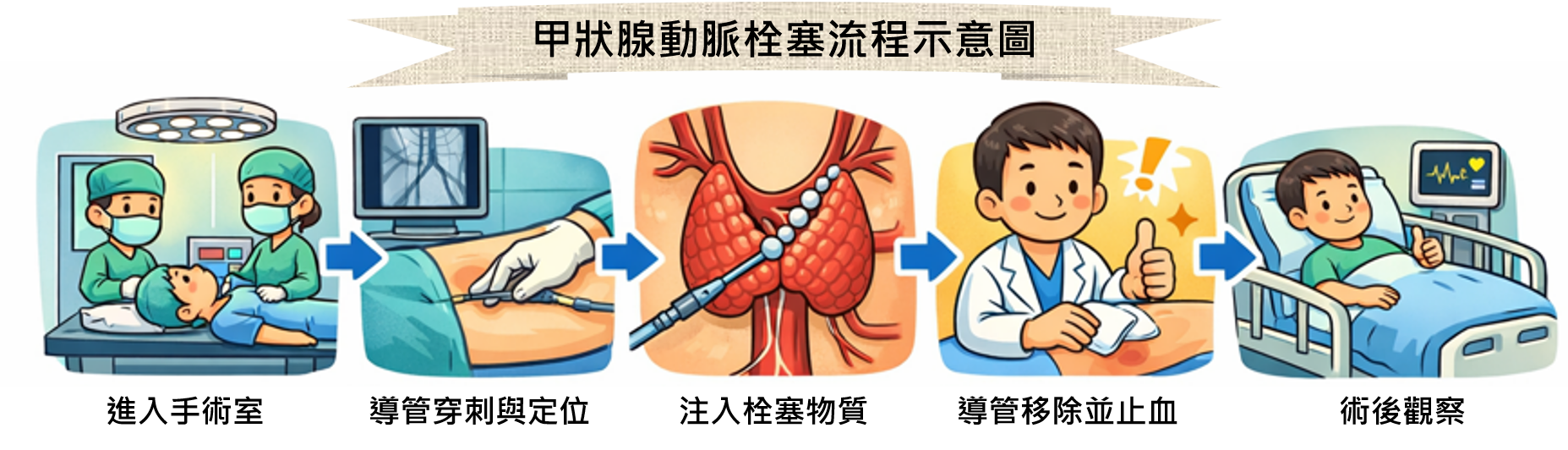 甲狀腺動脈栓塞治療流程